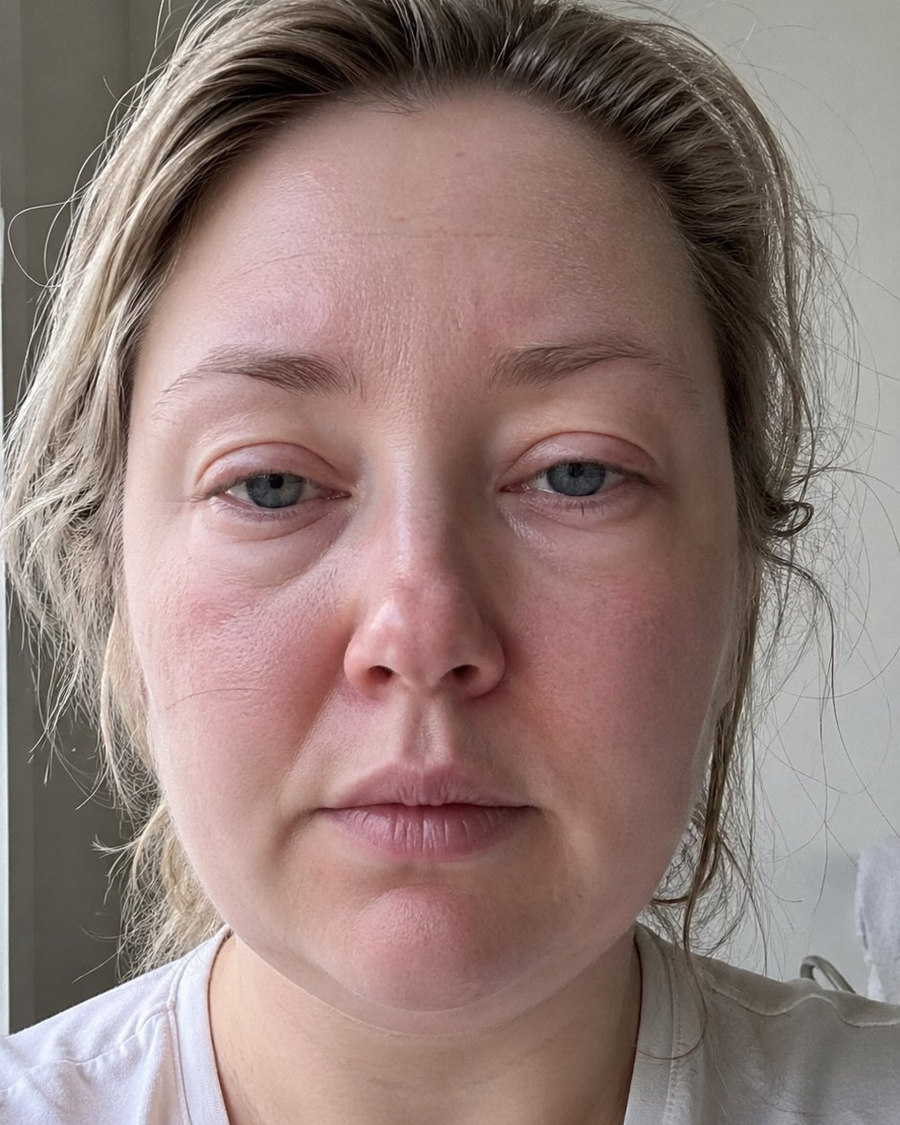 Before using VitaPulseo